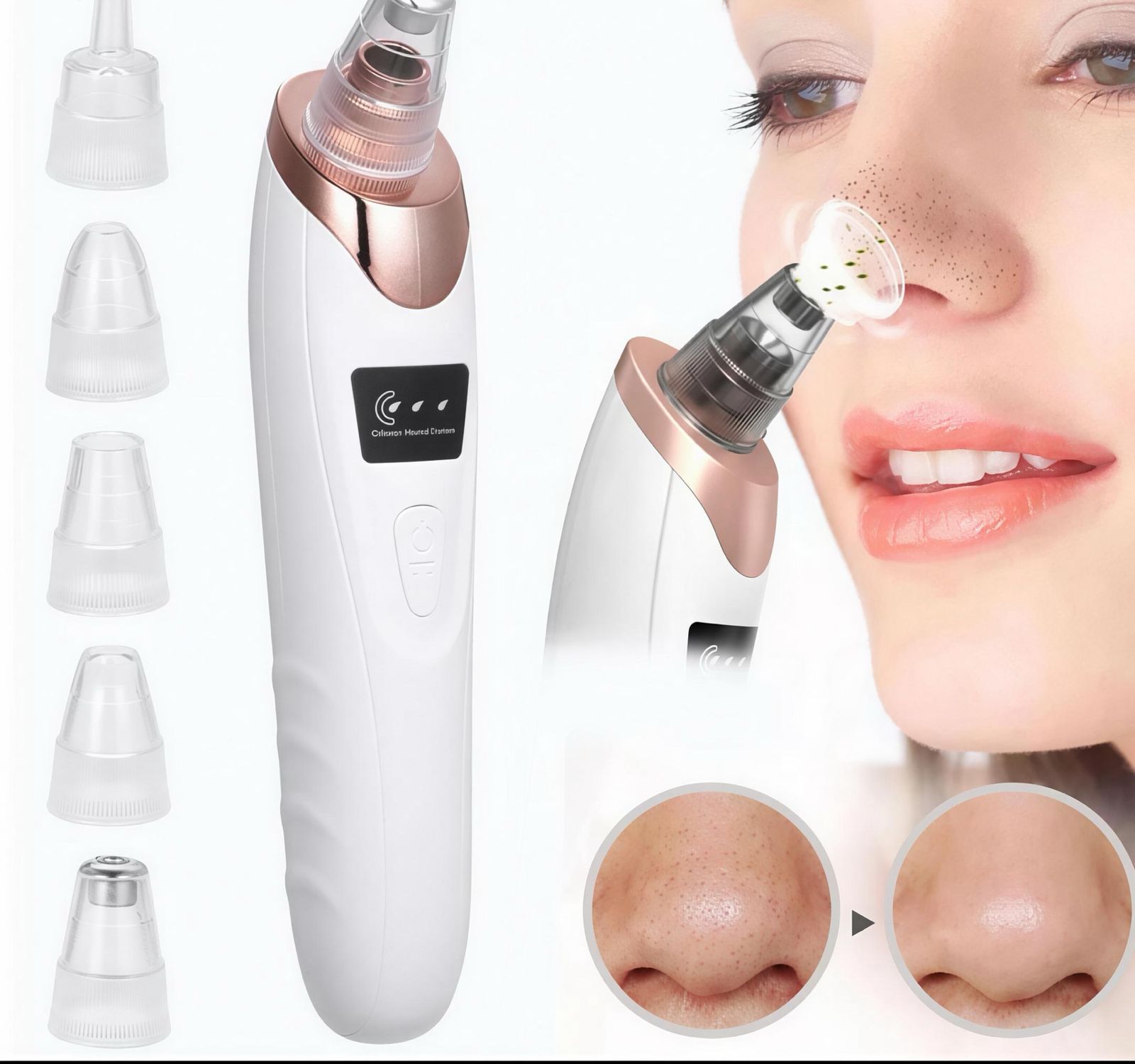 digital blackhead remover vacuum – electric pore cleaner & acne remover facial tool digital blackhead remover vacuum – electric pore cleaner & acne remover facial tool